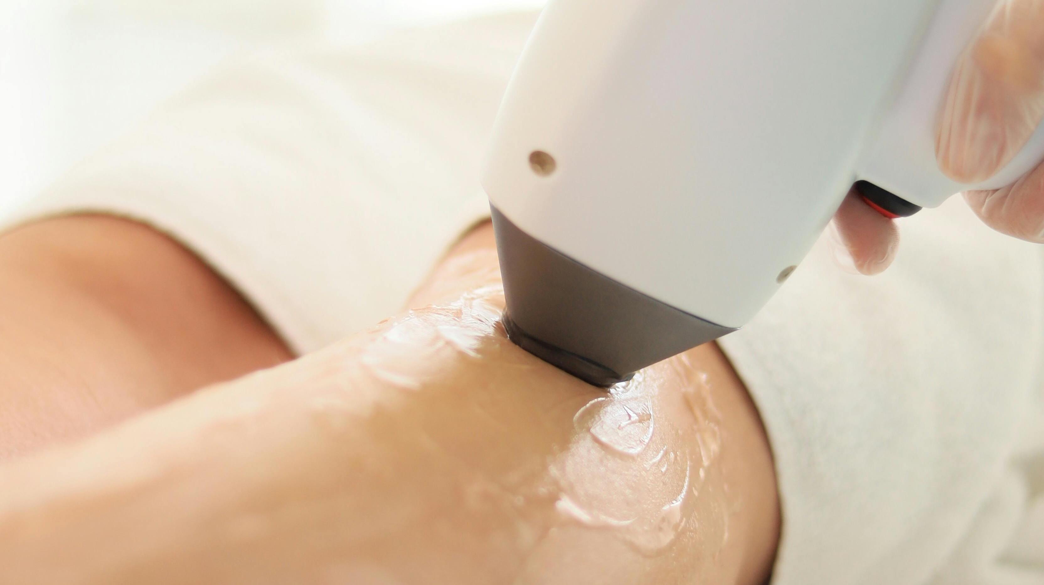 Elos Hair Removal Laser